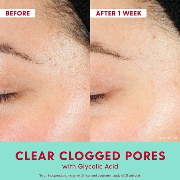 Kinship Self Smooth Glycolic Resurfacing Serum 0.20 oz - Picture 4 of 6